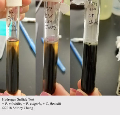 Microbiology: Lab 23-24, citrate test. – Basic Sciences