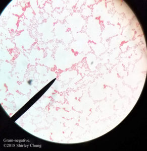 Microbiology: Lab 9, Gram stain examples. – Basic Sciences